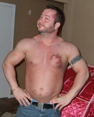 Heck with a bruised up chest