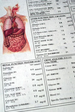 Test your cholesterol leves - total hdl and ldl