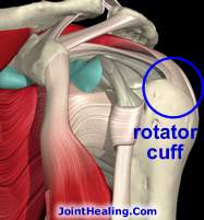 Rotator Cuff Problems