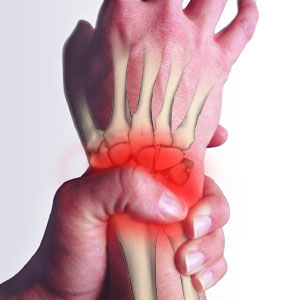 Stop Wrist Pain