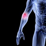 Joint Pain & Inflammation Relief