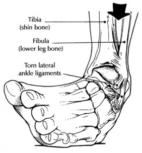 ankle mobility strategies 1